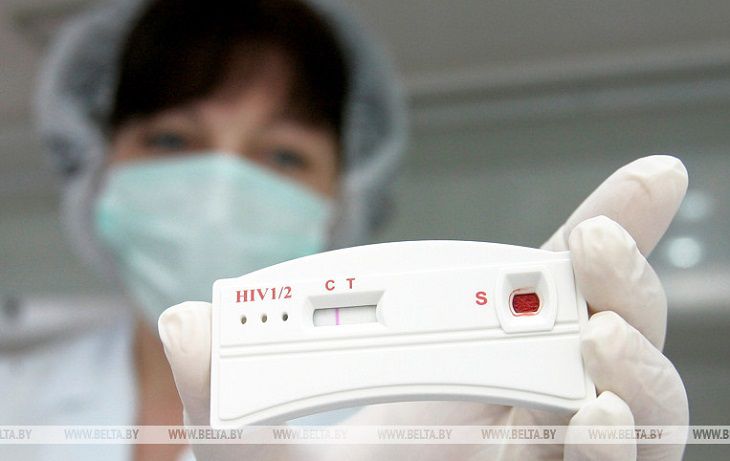 В Брестской области снизилась заболеваемость ВИЧ