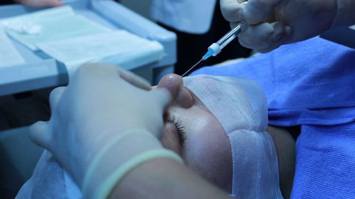 Медики рассказали об опасных последствиях усовершенствования внешности косметическая процедура, подкожная инъекция