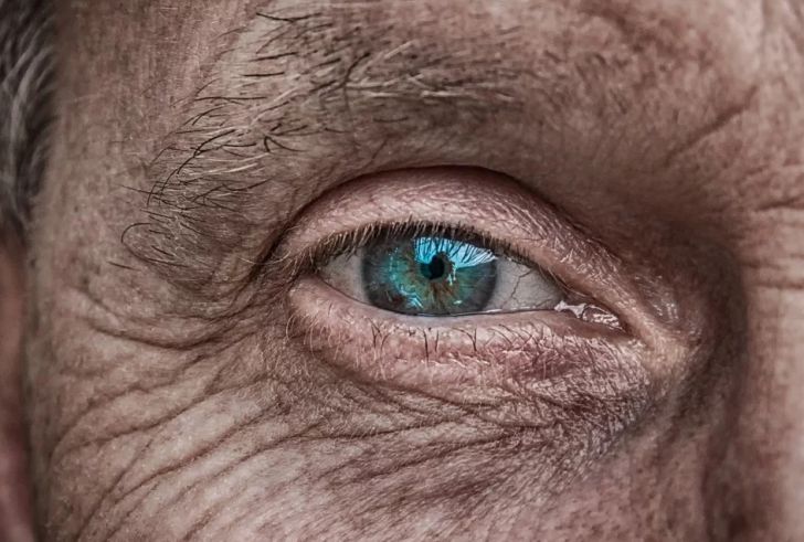 Ученые случайно открыли средство против старения кожи человеческий глаз, морщины