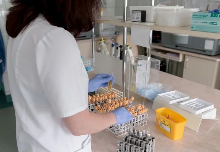 Ученые рассказали, как исправить умственную отсталость при синдроме Дауна лаборатория, анализ