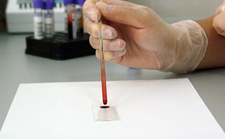 Один катетер на всех: детей и взрослых заразили ВИЧ в больнице