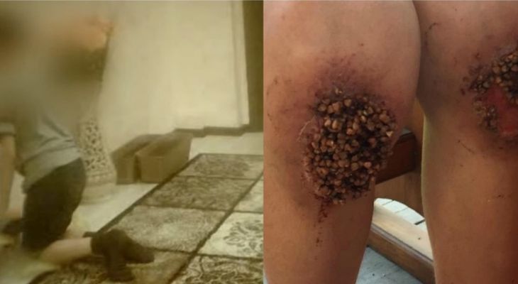 Жестокие наказания: мальчика заставили стоять на гречке, пока крупа не вросла в кожу