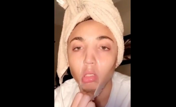 Из-за дешевой маски девушка чуть не осталась без лица 