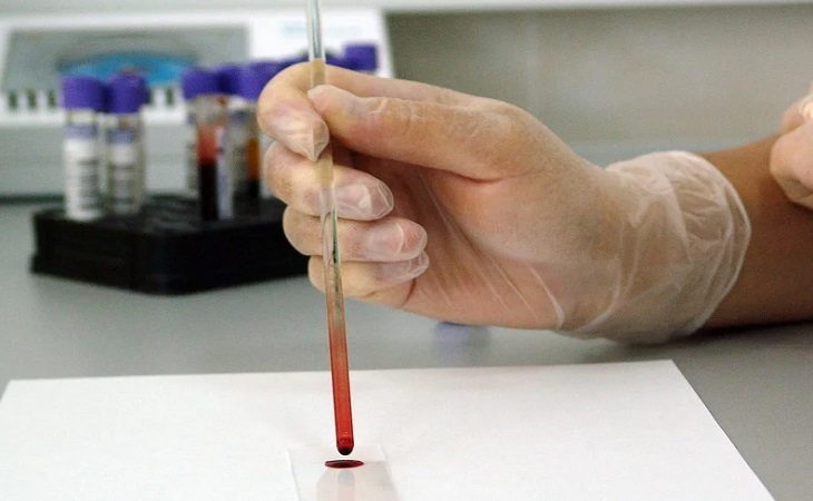 Неожиданно: в двух странах коронавирусом заразились люди, которые никогда не были в Китае Неожиданно: в двух странах коронавирусом заразились люди, которые никогда не были в Китае