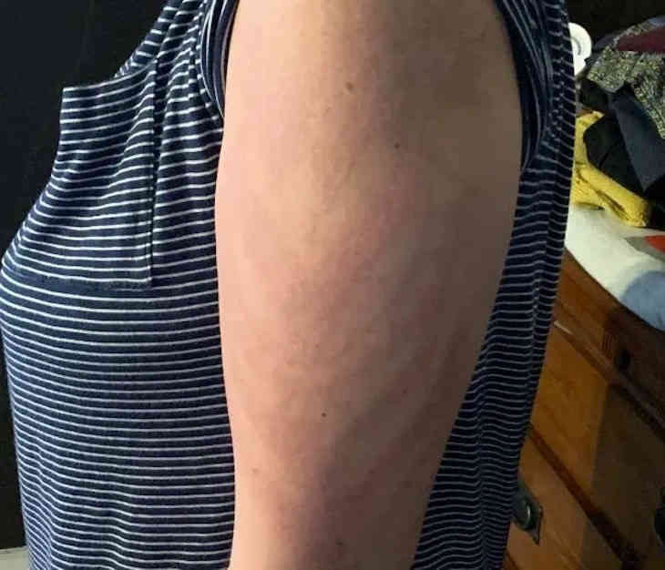 Девушка сделала временное тату, которое она запомнит на всю жизнь. Рисунок красивый, а последствия печальные рука