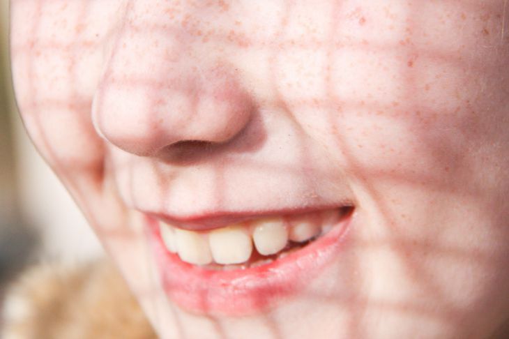 Ученые рассказали, почему люди чихают, выходя на яркий свет Чих