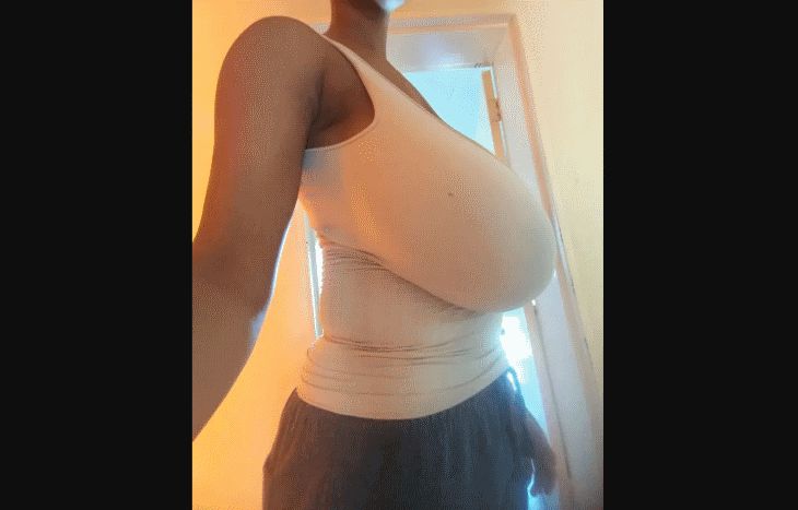 Обладательница пышной груди уменьшила ее и стала счастливее женщина