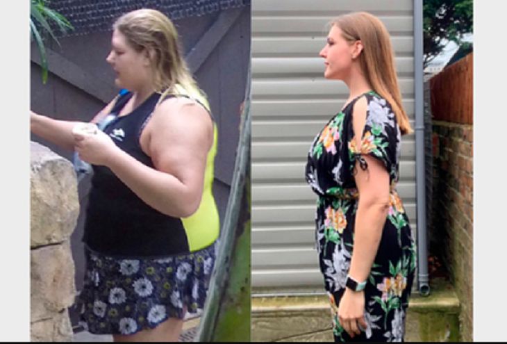 Девушка добилась идеального веса, но осталась с четырьмя килограммами складок кожи на животе cprsed