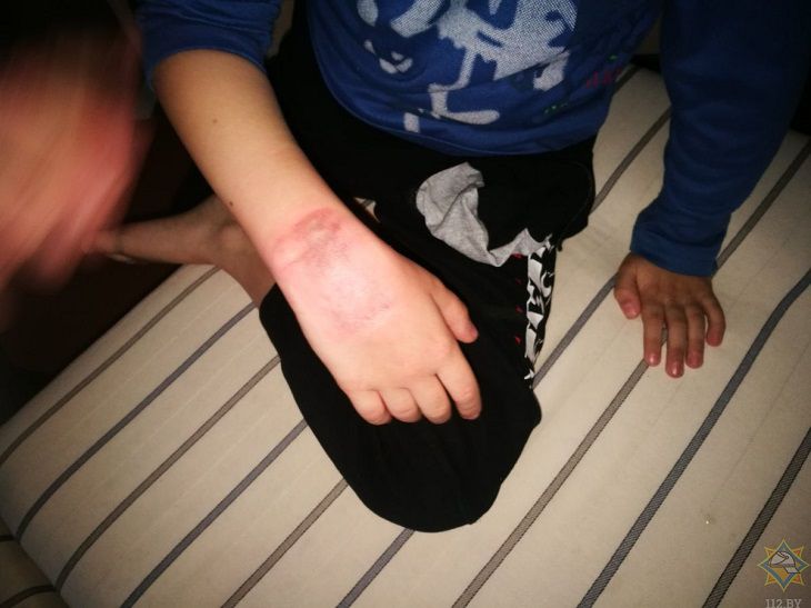 В Волковыске руку 8-летнего ребенка зажало в диване: потребовалась помощь спасателей фото