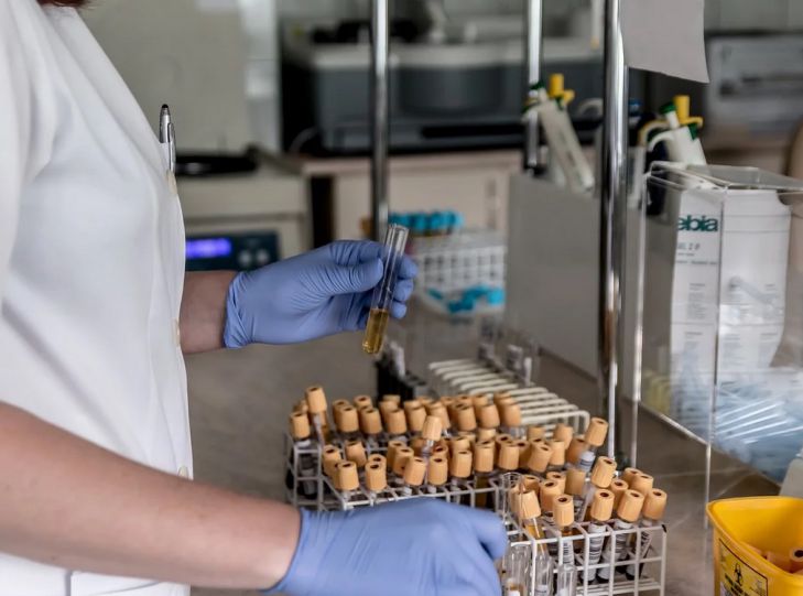 Ученые нашли новый способ выявления рака легких лаборатория