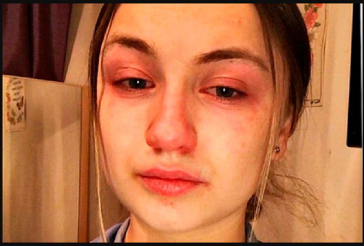 Медсестра, работающая по 13 часов ежедневно, рассказала о муках зараженных пациентов коронавирус