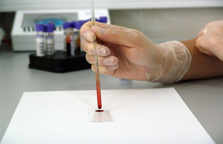 Ученые выяснили, как определить характер по группе крови