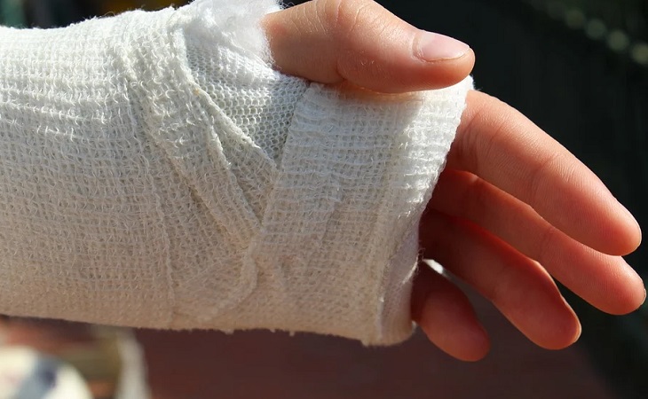 Пенсионерка из Гомеля отсудила у коммунальщиков 2 000 рублей за сломанную руку