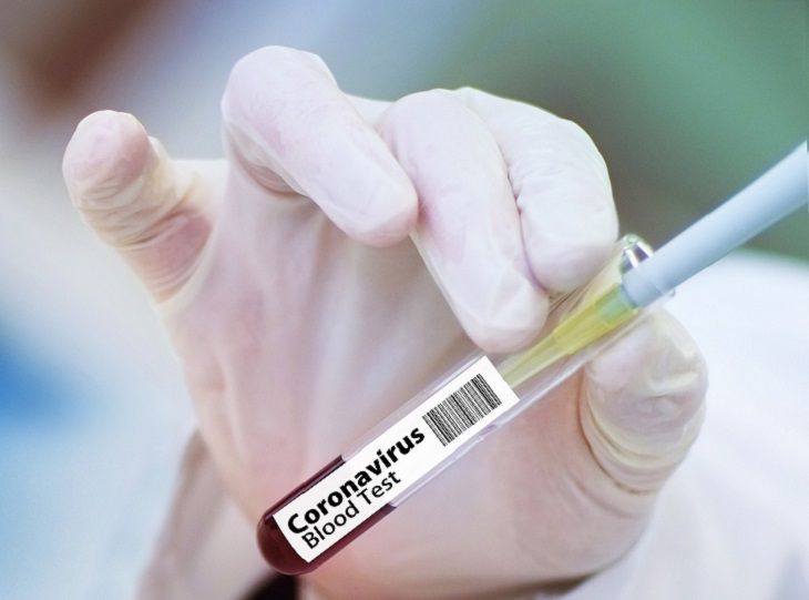 В России сократят сроки тестирования вакцины от COVID-19