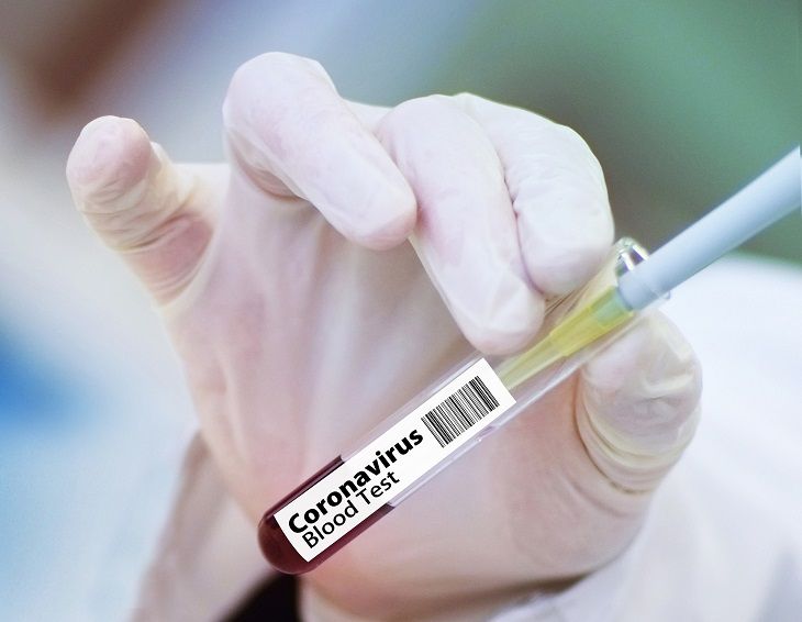 Страны ЕС объединились для создания вакцины против COVID-19 Страны ЕС объединились для создания вакцины против COVID-19