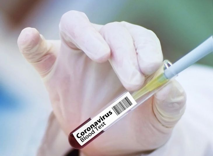 НАН: Беларусь займется разработкой вакцины против COVID-19