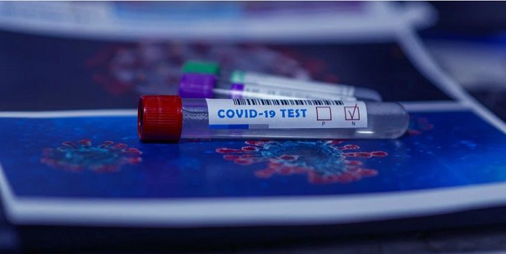 Минздрав рассказал, где в Минске делают экспресс-тесты на антитела к COVID-19