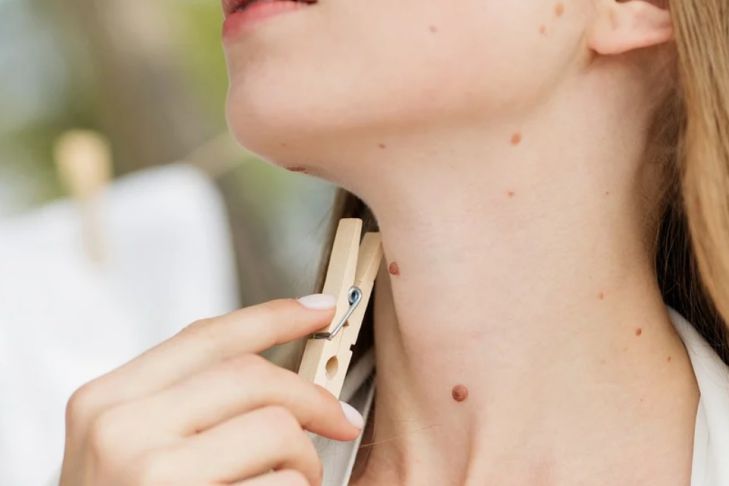 Телеведущая узнала об онкологии от зрительницы, когда вела эфир