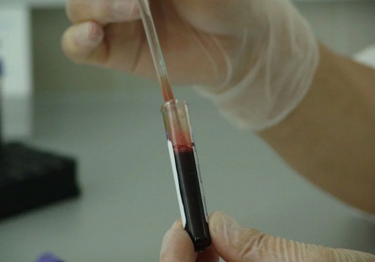 Выявлен первый в истории случай самостоятельного исцеления от СПИДа Выявлен первый в истории случай самостоятельного исцеления от СПИДа