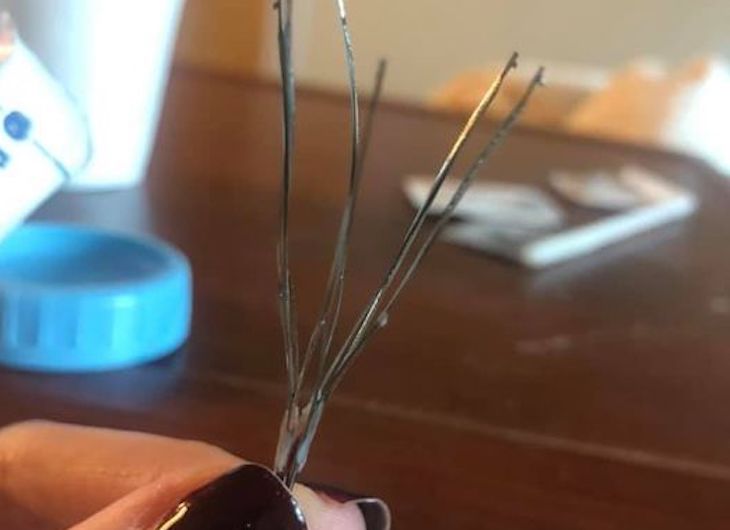 Это невозможно: Девушка показала устройство, которое помогло ей разбить тромб