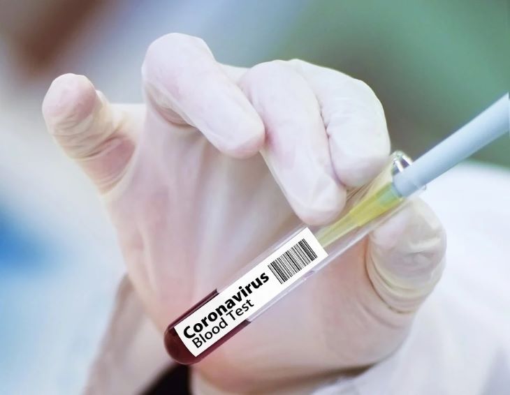 В Беларуси начали испытывать российскую вакцину от COVID-19