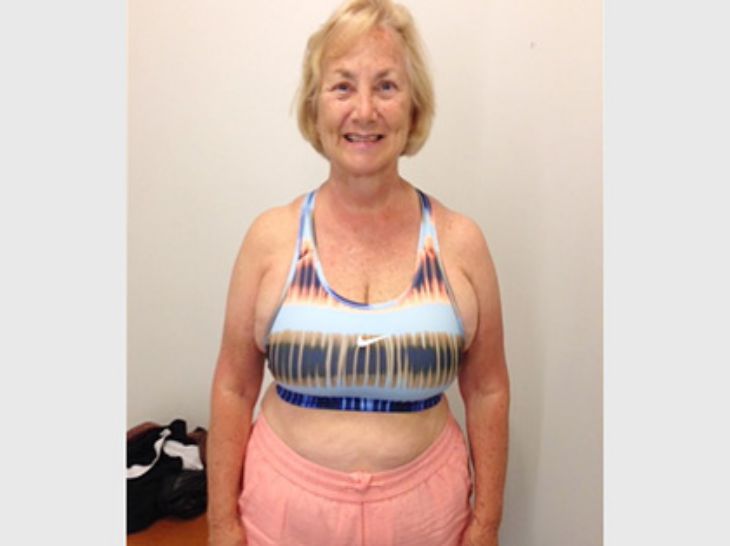 Пенсионерка сбросила 28 кг за полгода и рассказала, как ей это удалось