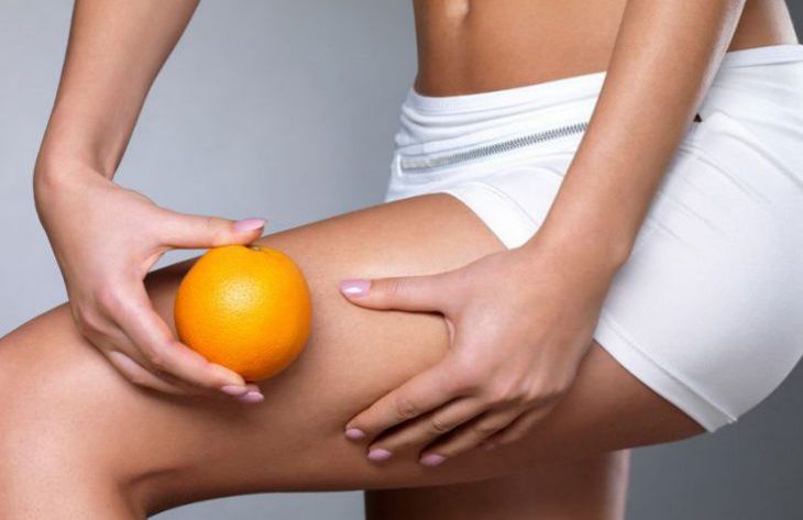 Названы 5 главных продуктов, вызывающих целлюлит Названы 5 главных продуктов, вызывающих целлюлит