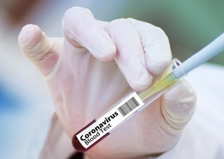 Минздрав: в Беларуси 592 человека заразились COVID-19 за сутки