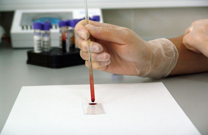Этот способ поможет узнать свою группу крови без сдачи анализов