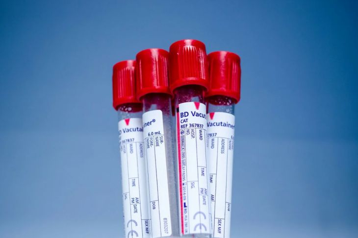 Стало известно, влияет ли группа крови на риск умереть от коронавируса Стало известно, влияет ли группа крови на риск умереть от коронавируса