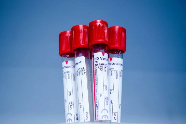 Ученые рассказали, какими необычными особенностями обладают люди с третьей группой крови