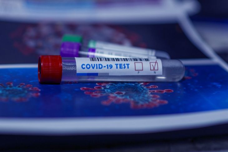 Тест Коронавирус
