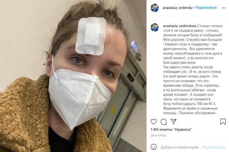 Бывшая жена актера Епифанцева показала фото травмы после драки в баре