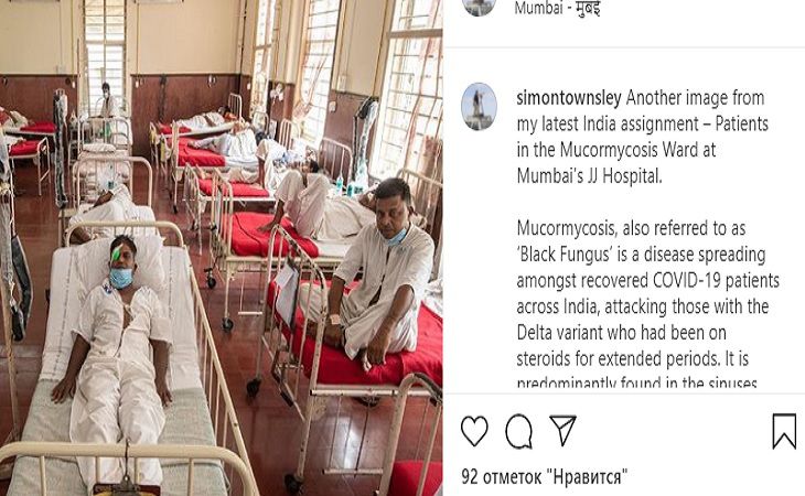 Страшные кадры из Индии: как черная плесень убивает выживших после коронавируса