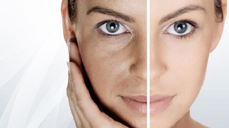 Что такое RF лифтинг? Что такое RF лифтинг?