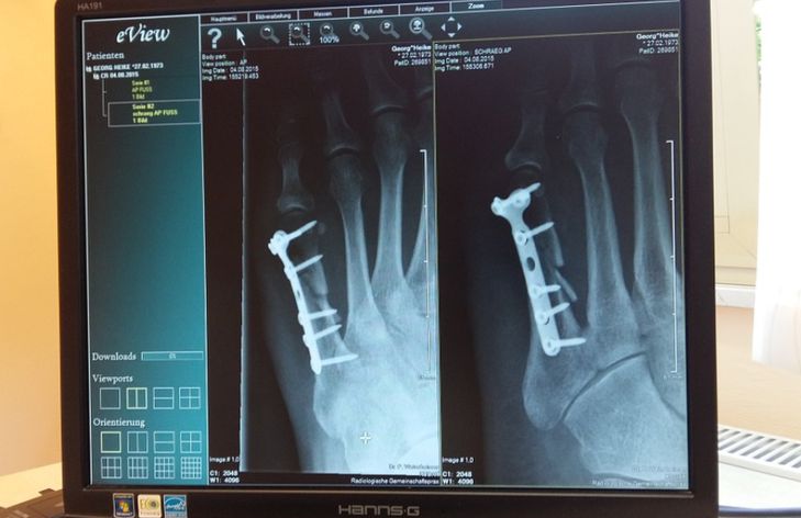 фотография