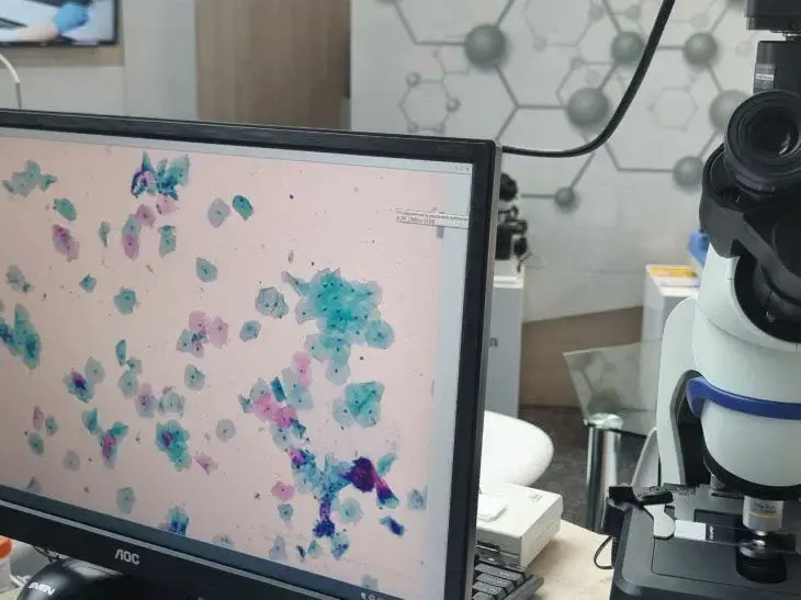 Болеющая раком блогер Лерчек заявила, что перенесла множество процедур ЭКО Медтехника