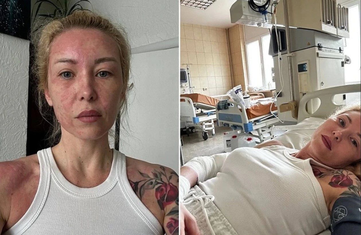 Вышла на связь попавшая в реанимацию дочь дрессировщика Запашного Екатерина Запашная