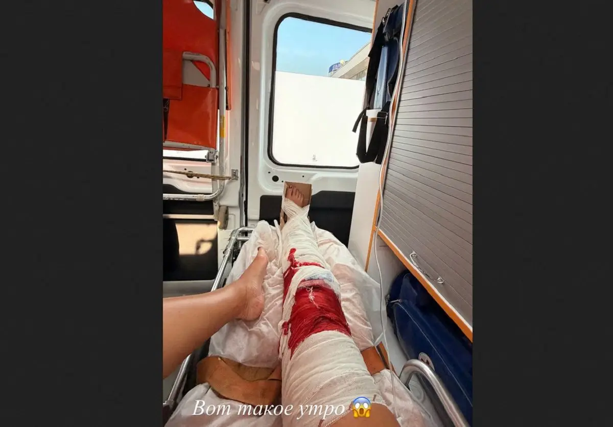 Ольга Бузова травмировалась у себя дома, окровавленную знаменитость госпитализировали травмированный человек