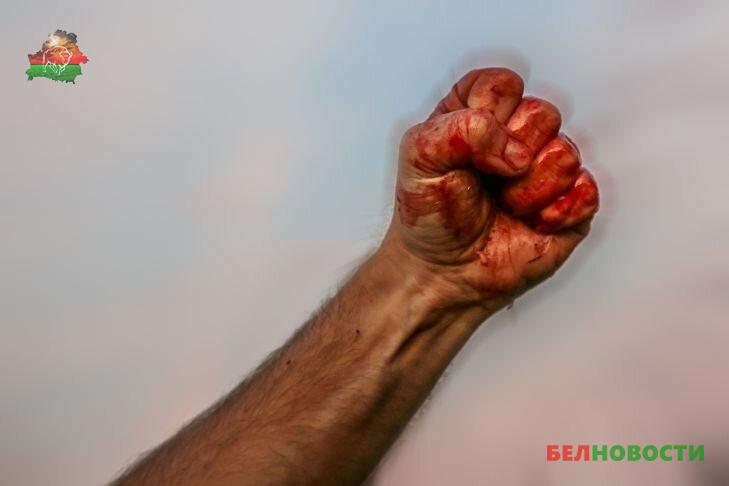 Почётного консула Бельгии жестоко избили во Львове из-за неправильной парковки Почётного консула Бельгии жестоко избили во Львове из-за неправильной парковки