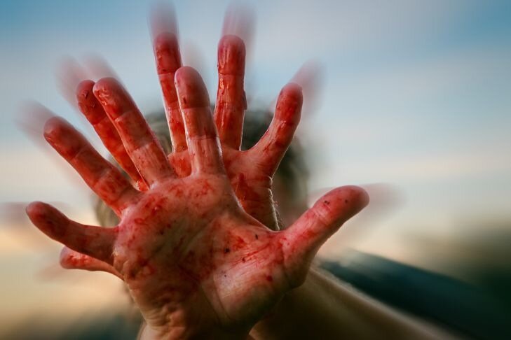 Выгуливал без поводка и намордника: в Кобрине собака покусала школьницу