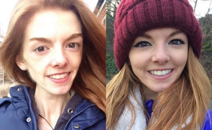 Девушка, весившая 29 кг, изменилась до неузнаваемости, и всё благодаря шоколаду Девушка, весившая 29 кг, изменилась до неузнаваемости, и всё благодаря шоколаду