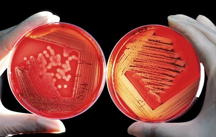 Ученые: Клетки бактерий могут переходить в режим зомби