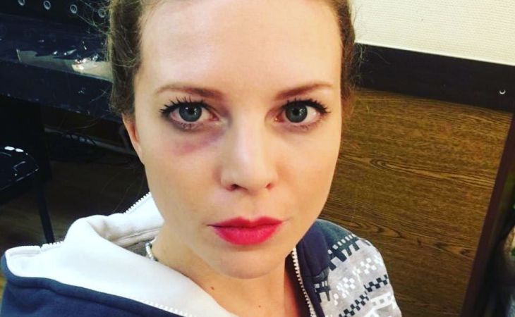 Наталья Подольская показалась с синяком под глазом: новости, наталья ...