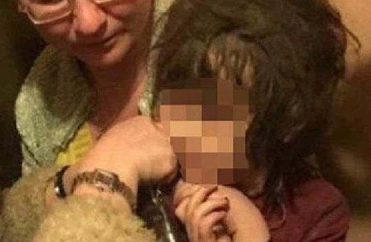 Врачи рассказали о состоянии девочки-маугли 