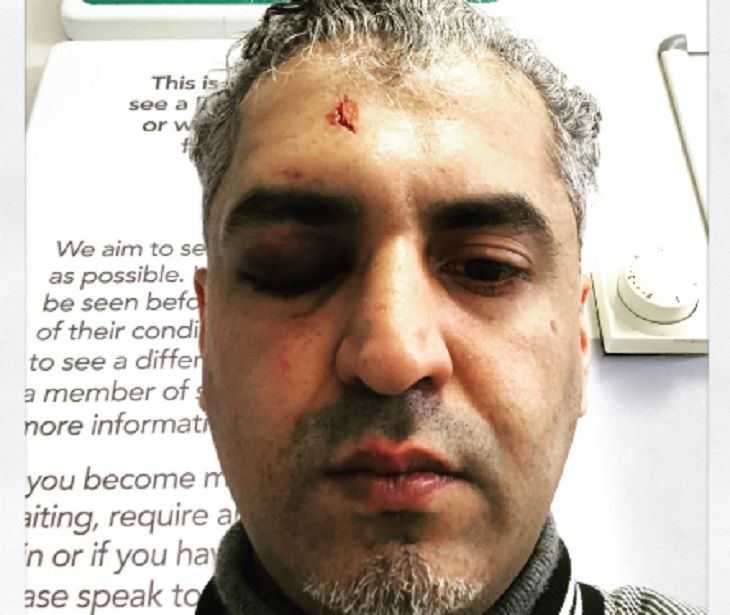 Известный радиоведущий стал жертвой нападения расиста