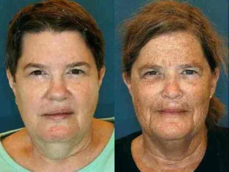 Одна привычка сделала идентичных близнецов совершенно разными: эти фото изменят вашу жизнь