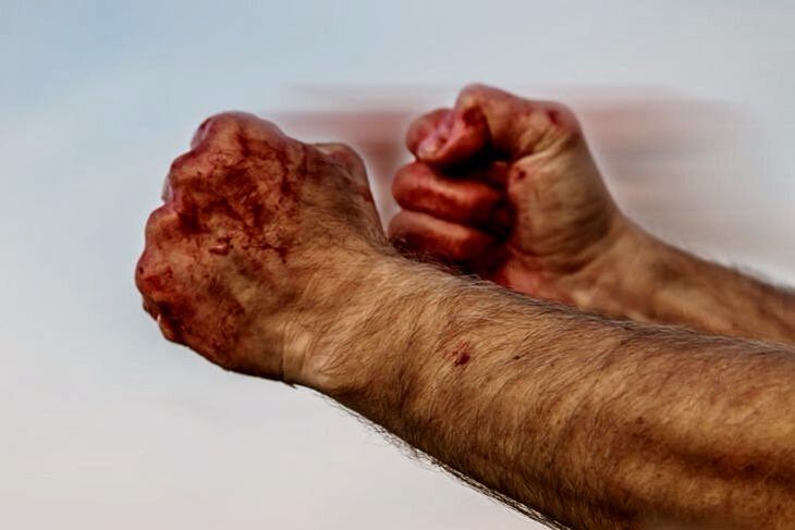 Мозырянин ударил девушку головой за то, что она мешала ему мочиться у ресторана