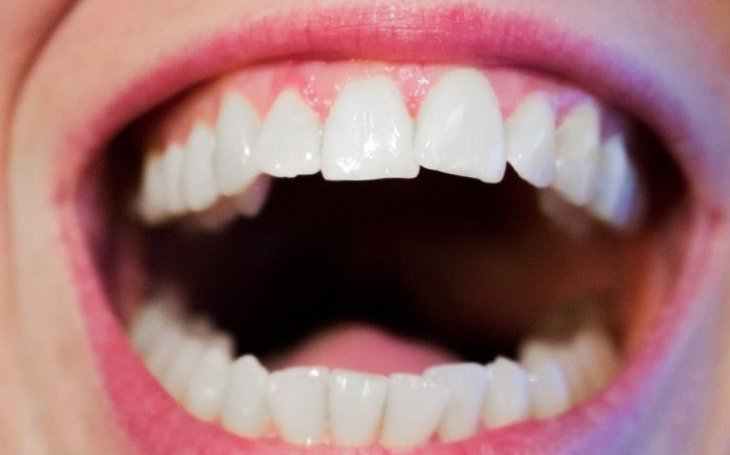 Мужчина почти 30 лет прожил с болтами вместо зубов