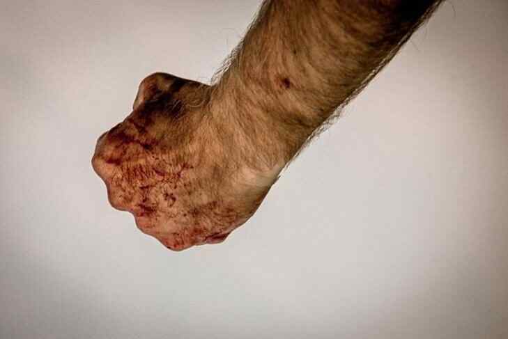 Минчанка познакомилась в баре с мужчиной – тот избил ее и похитил телефон